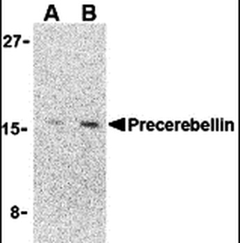 Precerebellin Antibody