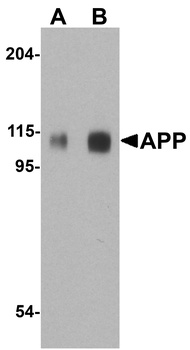 APP Antibody