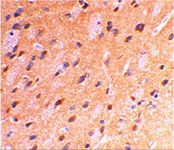 APP Antibody