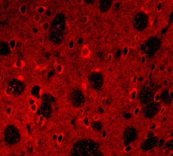 APP Antibody