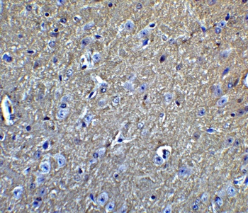 APP Antibody