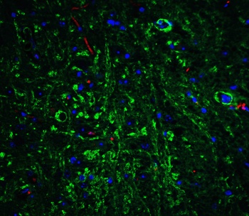APP Antibody
