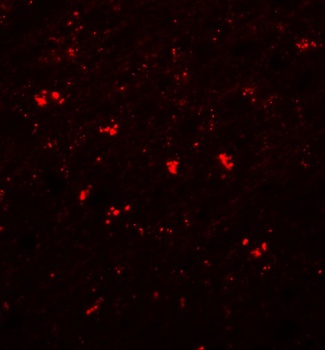 PPAPDC1A Antibody