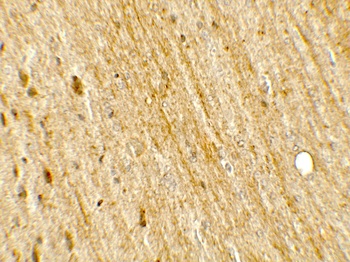 POU2F3 Antibody
