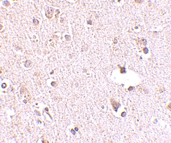 POLR3F Antibody