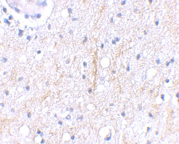 Plxdc2 Antibody