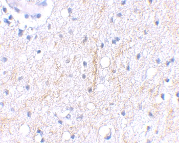 PLXDC2 Antibody