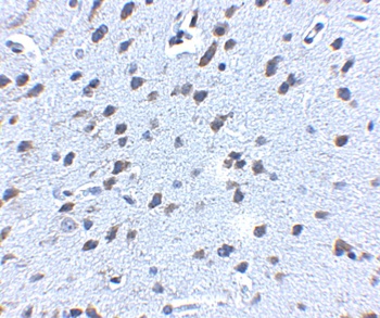 APP Antibody