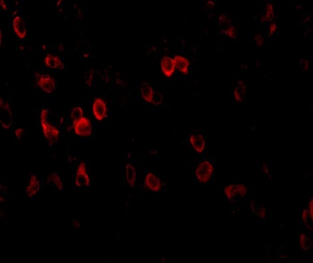 APP Antibody