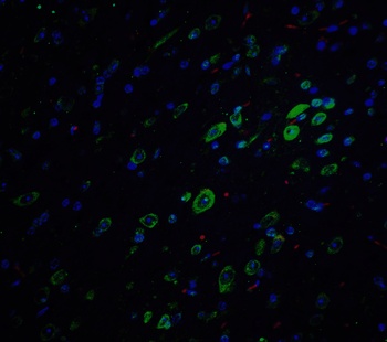APP Antibody
