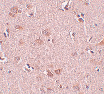 PLEKHM2 Antibody