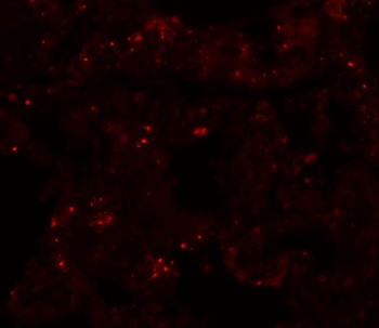 PLEKHM1 Antibody