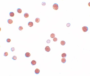 PLAC4 Antibody