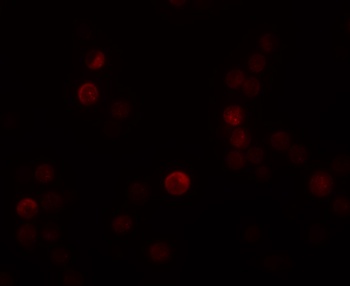 PLAC4 Antibody