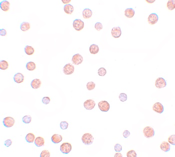 PLAC3 Antibody
