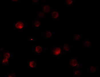 PLAC3 Antibody