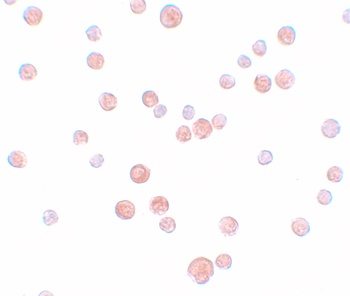 TINCR Antibody