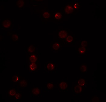TINCR Antibody