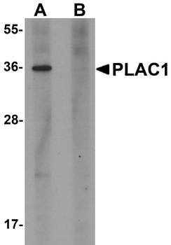 PLAC1 Antibody