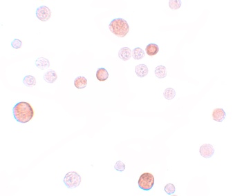 PLAC1 Antibody