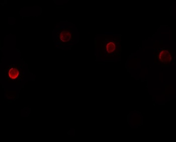 PLAC1 Antibody