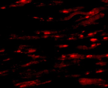 ASAH1 Antibody