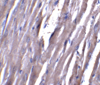 ASAH1 Antibody