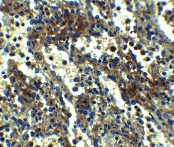 ASC Antibody