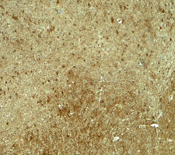 PJA1 Antibody