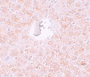PIWIL1 Antibody