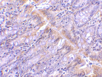PIST Antibody
