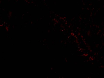 PIST Antibody