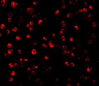 ATF6 Antibody