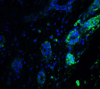 ATF6 Antibody