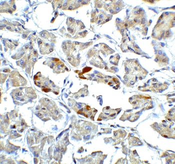 ATF6 Antibody