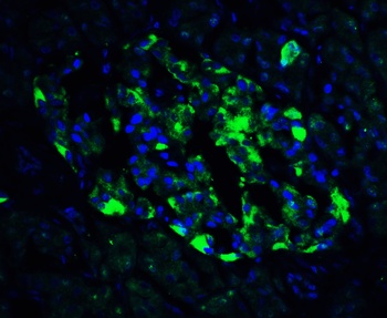 ATF6 Antibody