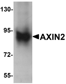 AXIN2 Antibody