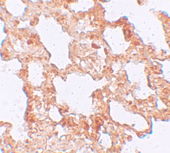 AXIN2 Antibody