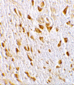 AGAP2 Antibody