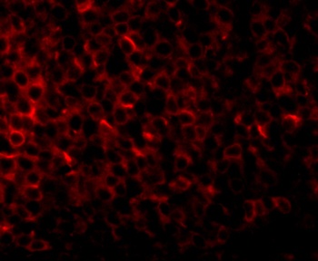 PIG-Y Antibody