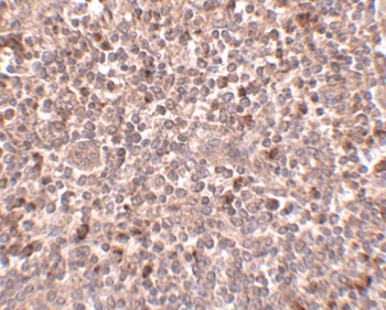 PIG-Y Antibody
