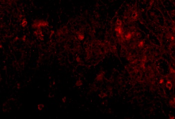 PIG-Y Antibody