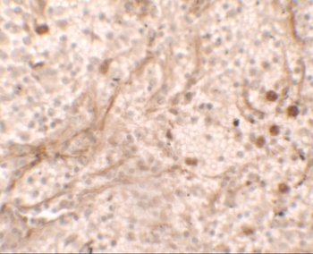 PIBF1 Antibody