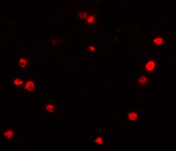 PIBF1 Antibody