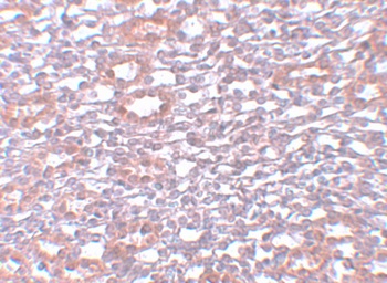 PIAS1 Antibody