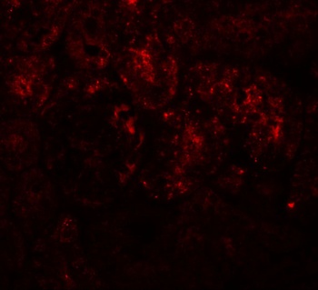 PIAS1 Antibody