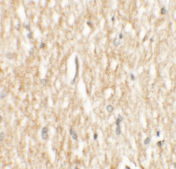 PHOX2A Antibody