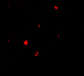 PHLPP1 Antibody