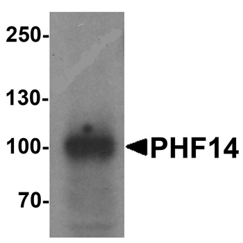 PHF14 Antibody