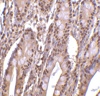PHAP III Antibody